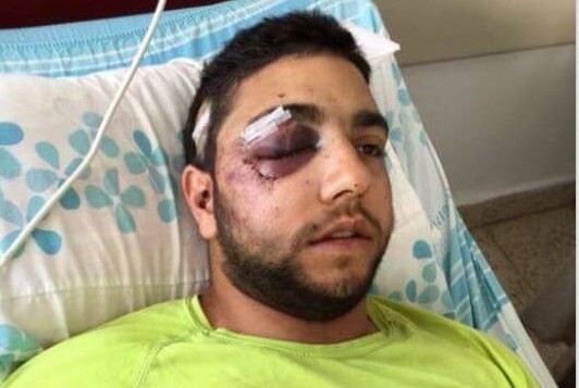 رازي حسيسي شاب درزي  وجندي في الجيش الإسرائيلي  من دالية الكرمل تعرض للضرب المبرح لتحدثه باللغة العربية الجمعة 6 فبراير، 2015،   Courtesy