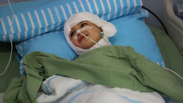 احمد دوابشة البالغ خمس سنوات يرقد في سريره في مركز شيبا الطبي في تال هاشومير  اسبوع بعد الهجوم (Eric Cortellessa/Times of Israel)