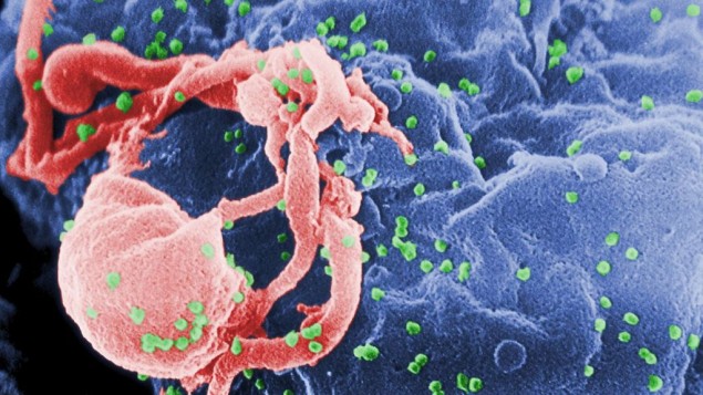 (Wikimedia Commons, public domain/Centers for Disease Control and Prevention's Public Health Image Library)