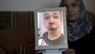 والدة طارق أبو خضير(15 عاما)، إبن عم الفتى الفلسطيني المقتول محمد، تعرض الصورة التي التقطتها لإبنها في المستشفى بعد أن تعرض للضرب على يد شرطي إسرائيلي من عناصر حرس الحدود في القدس الشرقية، 5 يوليو، 2014. (photo credit: AFP/Ahmad Gharabli)