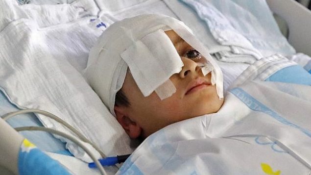 صورة تم التقاطها في 12 أغسطس، 2019 للطفل الفلسطيني عبد الرحمن شتيوي، في سرير بمستشفى ’شيبا’ في رمات غان.  (JACK GUEZ / AFP)