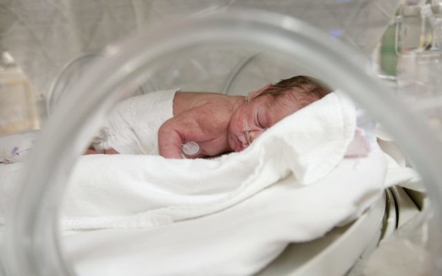 A premature infant in an incubator. A premature infant in an incubator.