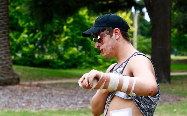 The victim shows his injuries following last week's attack. Photo: Peter Haskin The victim shows his injuries following last week's attack. Photo: Peter Haskin