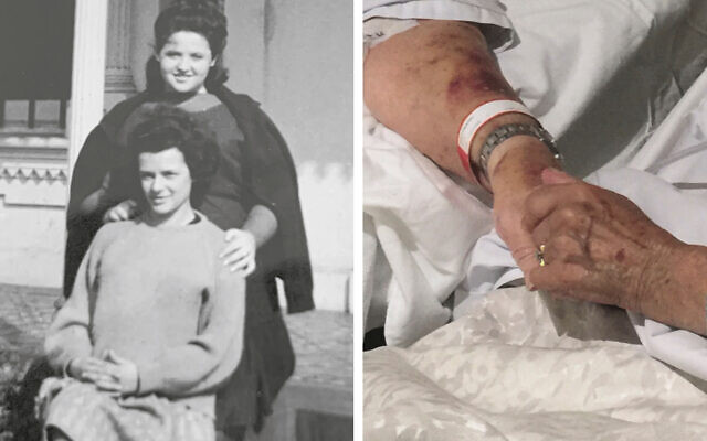 Left: Asia Gutmann (back) and
Vera Friedman as teenagers. Right: Vera and Asia holding hands in their
hospital beds. Left: Asia Gutmann (back) and
Vera Friedman as teenagers. Right: Vera and Asia holding hands in their
hospital beds.