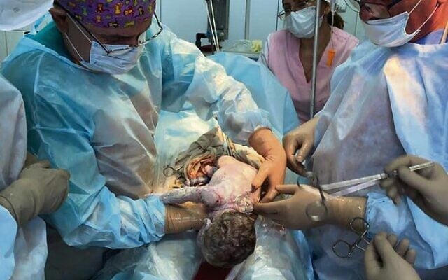 Doctors delivered a baby via caesarean section last Thursday. Doctors delivered a baby via caesarean section last Thursday.