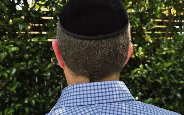 Julian Leeser wears his kippah. Julian Leeser wears his kippah.
