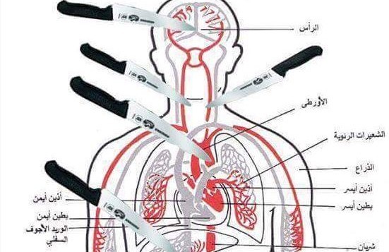 مخطط تشريحي تم نشره على فيسبوك من قبل زهران بربه في 8 أكتوير، 2015، يظهر أجزاء الجسم التي "يُنصح" بإستهدافها عند طعن الضحية. (المصدر: MEMRI) مخطط تشريحي تم نشره على فيسبوك من قبل زهران بربه في 8 أكتوير، 2015، يظهر أجزاء الجسم التي "يُنصح" بإستهدافها عند طعن الضحية. (المصدر: MEMRI)