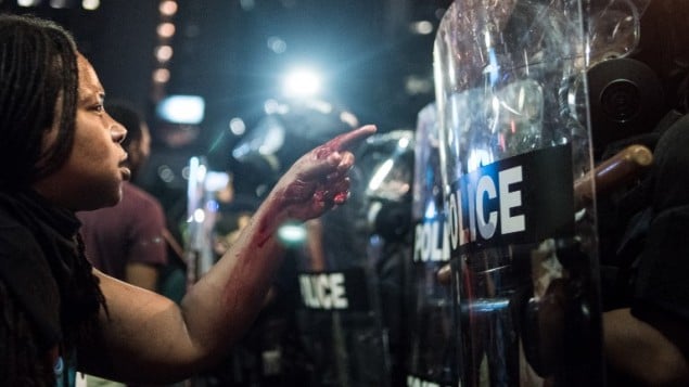 امرأة تغطي يداها الدماء امام عناصر الشرطة خلال مظاهرات في شارلوت، كارولاينا الشمالية، 21 سبتمبر 2016 (Sean Rayford/Getty Images/AFP)