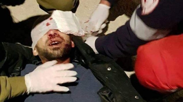 فلسطيني يتلقى العلاج من جنود اسرائيليين بعد اصابته في الرأس نتيجة رشق مستوطنين لحجارة بالقرب من مدخل نابلس في الضفة الغربية، 5 فبراير 2018 (Courtesy)
