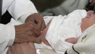 صورة توضيحية لعملية ختان (yoglimogli, iStock by Getty Images))