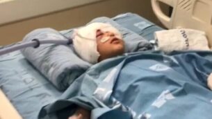 طفل (9 سنوات) أصيب في رأسه برصاصة إسفنجية خلال مداهمة للشرطة في حي العيساوية بالقدس الشرقية، في مستشفى بالقدس، 26 فبراير، 2020. (Screencapture/Channel 13)