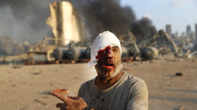رجل مصاب يسير في موقع الانفجار الذي هز مرفأ العاصمة اللبنانية بيروت، 4 أغسطس، 2020.(AP Photo/Hussein Malla)