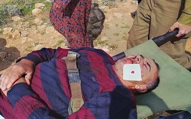 أحد أفراد عائلة عليان بعد هجوم مزعوم من قبل مستوطنين ملثمين جنوب مدينة الخليل بالضفة الغربية، 13 مارس 2021 (B'Tselem)