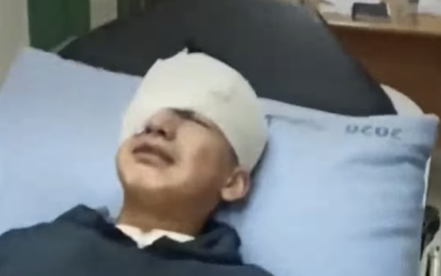 عز الدين نضال البطش، 14 عاما، أصيب برصاصة مطاطية أطلقتها كما يُزعم القوات الإسرائيلية، في مستشفى سانت جون للعيون في القدس. (screenshot)