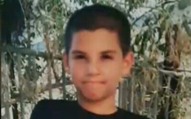 محمد ، فتى من يافا أصيب بجروح خطيرة بعد إلقاء زجاج حارقة على منزله، 14 مايو، 2021.  (Channel 12 screenshot)