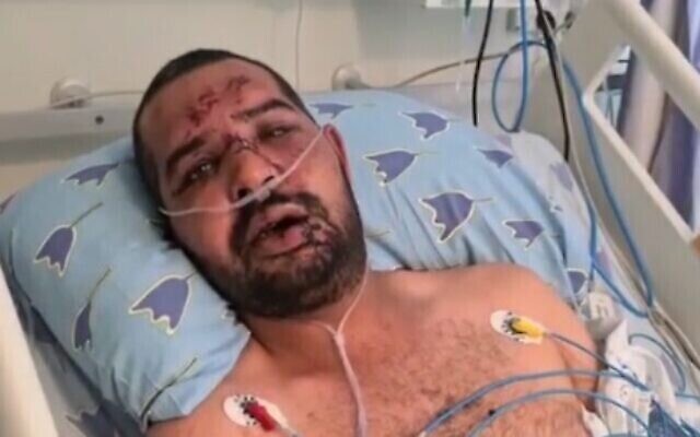 سعيد موسى، مواطن عربي إسرائيلي تعرض لاعتداء من قبل حشد من اليهود الإسرائيليين، في مركز إيخيلوف الطبي، 14 مايو، 2021.  (video screenshot)