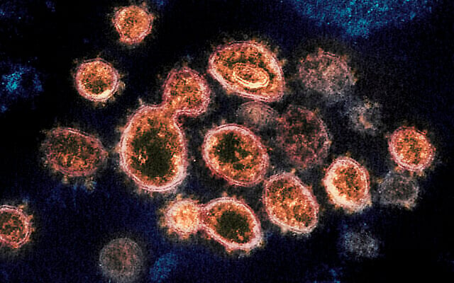 جزيئات فيروس SARS-CoV-2 ، التي تسبب كوفيد-19 ، معزولة من مريض في الولايات المتحدة ، تخرج من سطح خلايا مزروعة في المختبر.(NIAID-RML via AP)