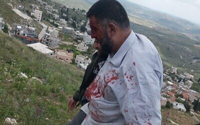رجل فلسطيني بعد تعرضه للضرب على أيدي مستوطنين إسرائيليين، 30 أبريل 2023 (via WAFA)