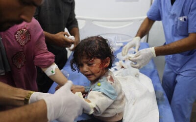 طفلة فلسطينية أصيبت في غارة جوية إسرائيلية على ما قال الجيش الإسرائيلي إنه مجمع تابع لحماس، بجوار مخيم للنازحين في رفح، في وقت متأخر من 26 مايو، 2024 - تتلقى العلاج في مستشفى في رفح (Eyad BABA / AFP)