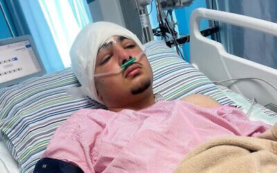 مشهور كوك (16 عاما)، من بلدة ترمسعيا الفلسطينية، أصيب بجروح خطيرة في رأسه بسبب حجر ألقاه عليه إسرائيلي بواسطة مقلاع من مستوطنة قريبة، يوم السبت، 15 يناير، 2025.  (Courtesy)