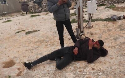 رجل فلسطيني مصاب إثر تعرضه لهجوم من قبل متطرفين إسرائيليين في منطقة تلال جنوب الخليل بالضفة الغربية، 22 يناير 2025. (Courtesy, Haqel - In Defense of Human Rights)