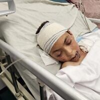 طفل فلسطيني جريح، وهو الطفل الوحيد الناجي من عائلة الطبيبة آلاء النجار، يرقد على سرير في مستشفى ناصر في خان يونس بعد أن أصيب في غارة جوية على منزله. فقدت النجار 9 من أطفالها العشرة في الهجوم الذي وقع بعد مغادرتها إلى العمل بوقت قصير. (Hani Alshaer / Anadolu via Reuters)
