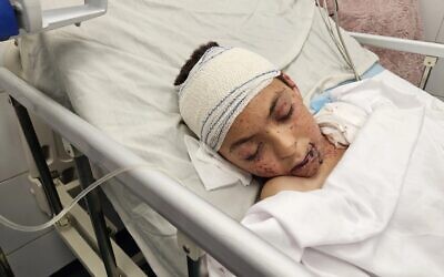 طفل فلسطيني جريح، وهو الطفل الوحيد الناجي من عائلة الطبيبة آلاء النجار، يرقد على سرير في مستشفى ناصر في خان يونس بعد أن أصيب في غارة جوية على منزله. فقدت النجار 9 من أطفالها العشرة في الهجوم الذي وقع بعد مغادرتها إلى العمل بوقت قصير. (Hani Alshaer / Anadolu via Reuters)