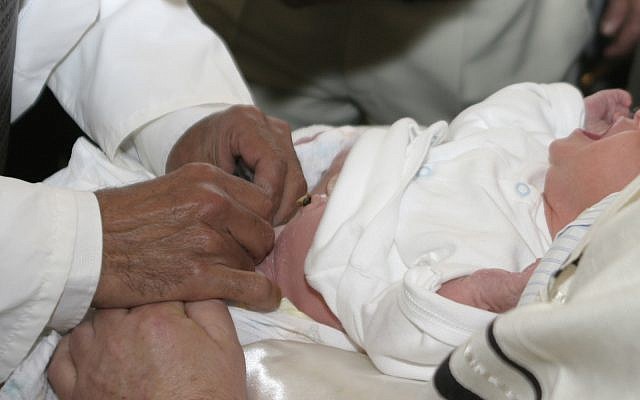 Circumcision (iStock)