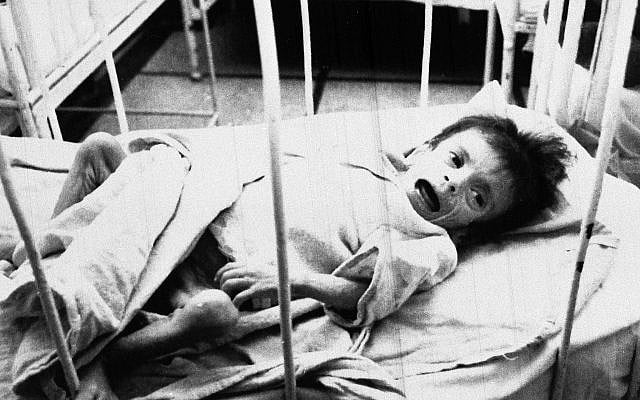 An orphaned child lies in a cot on the AIDS ward at Victor Babes Hospital in Bucharest, Romania, Feb. 7, 1990. (AP Photo/Peter Dejong)