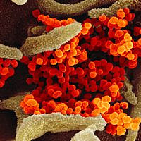 In this image from a scanning electron microscope, the new coronavirus is in orange.
