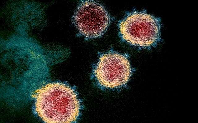 This transmission electron microscope image shows SARS-CoV-2—also known as 2019-nCoV, the virus that causes COVID-19—isolated from a patient in the U.S. Virus particles are shown emerging from the surface of cells cultured in the lab. The spikes on the outer edge of the virus particles give coronaviruses their name, crown-like. Credit: NIAID-RML / CC BY 2.0 // NIAID - https://www.flickr.com/photos/niaid/49534865371/