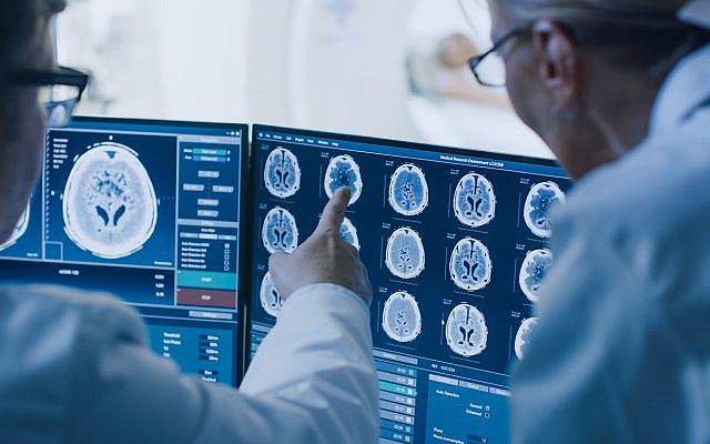 Illustrative. Brain scans. (iStock)