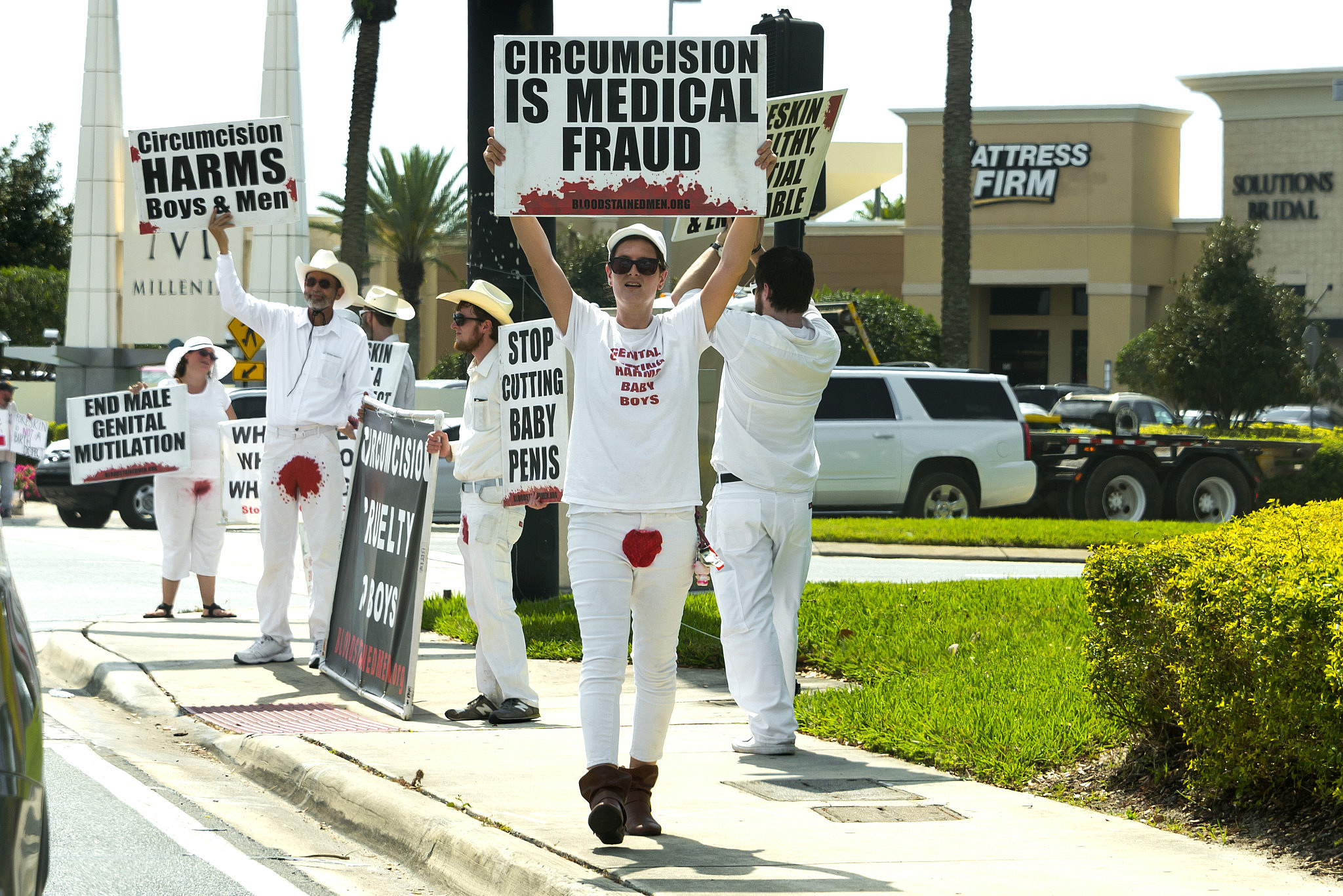 The Blogs: The case for circumcision