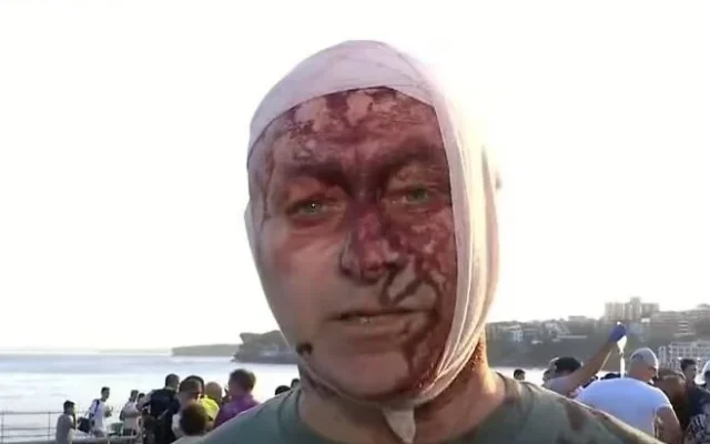 Arsen Ostrovsky, who was with his family at Bondi Beach in Sydney, during the deadly December 14, 2025, terror shooting, describes the attack in an Australian TV interview. (Sky News Australia screenshot)