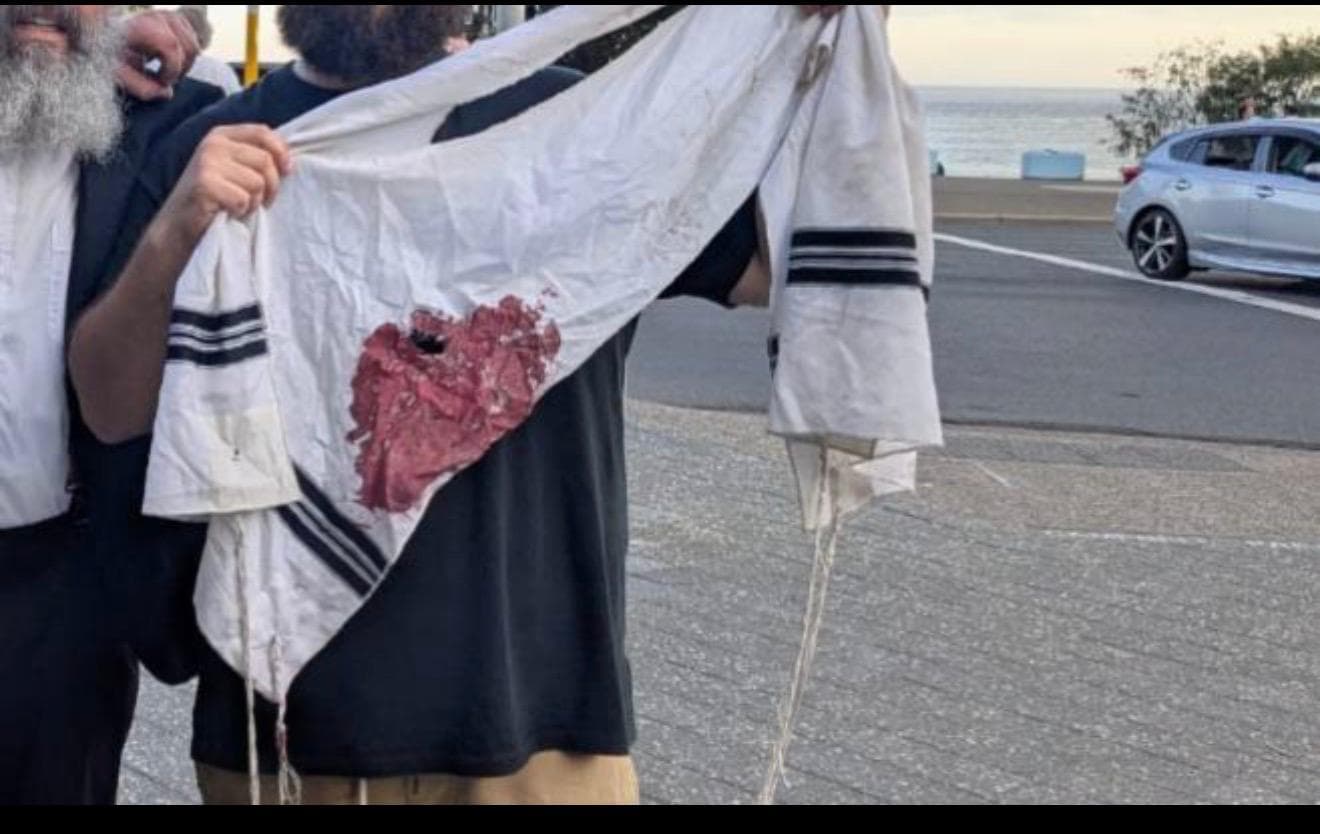 Bondi Beach, the Blame Game, and the Death of Human Empathy