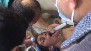 توضیح تصویر: پزشک سوری در پی حمله‌ی مظنون به شیمیایی، در حال مداوای پسری در شهر خان شیخون، شمال استان ادلیب سوریه است – ۴ آوریل ۲۰۱۷