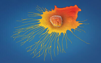 تصویر تزئینی: عکس آرشیو از سلول سرطانی پستان. (Christoph Burgstedt via iStock by Getty Images)
