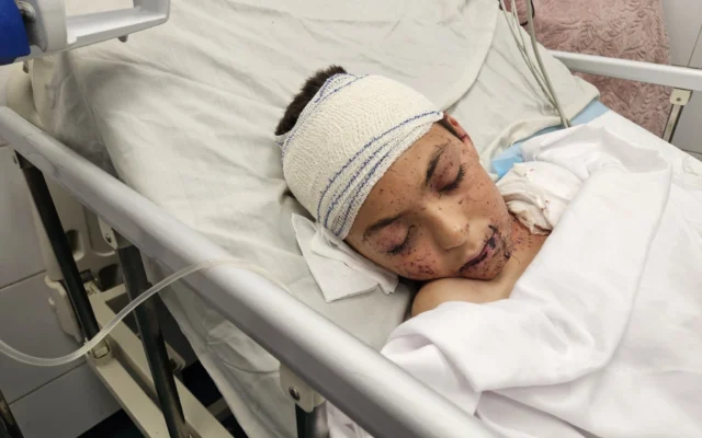 شرح عکس: کودک مجروح فلسطینی، تنها فرزند بازماندهٔ دکتر علاء النجار، بعد از اصابت حملهٔ هوایی اسرائيل به خانهٔ وی، روی تخت بیمارستان ناصر در خان یونس خوابیده است. النجار ۹ فرزند خود را در این حمله که اندکی بعد از خروج وی از خانه به قصد محل کار واقع شد، از دست داد. (Hani Alshaer / Anadolu via Reuters)