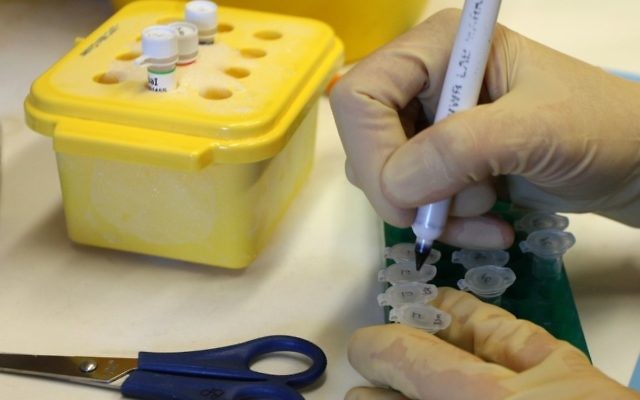 Illustration : Un scientifique fait une recherche contre le cancer dans un laboratoire de l'Hôpital Hadassah. Israël est devenu un pôle des recherches contre cette maladie.  (Crédit : KEREN FREEMAN/FLASH90)