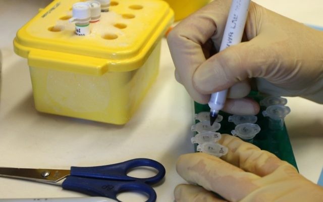 Recherche sur le cancer au laboratoire Ben-Porath de l'hôpital Hadassah de Jérusalem. Illustration. (Crédit : Keren Freeman/Flash90) Recherche sur le cancer au laboratoire Ben-Porath de l'hôpital Hadassah de Jérusalem. Illustration. (Crédit : Keren Freeman/Flash90)
