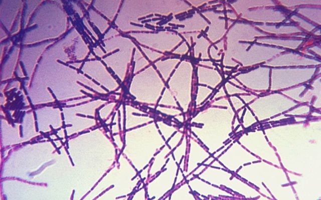 A photomicrograph of Bacillus anthracis bacteria using Gram-stain technique. Anthrax is diagnosed by isolating B. anthracis from the blood, skin lesions, or respiratory secretions, or by measuring specific antibodies in the blood of persons with suspected cases. (photo credit:  Centers for Disease Control and Prevention, US Department of Health and Human Services/Wikipedia Commons)