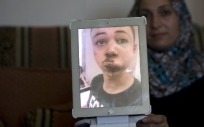 La mère de Tariq Abou Khdeir (le cousin de l'adolescent tué) montre une image de son fils qui aurait été battu par la police israélienne à Jérusalem-Est le 5 juillet 2014 (Crédit photo: Ahmad Gharabli / AFP)