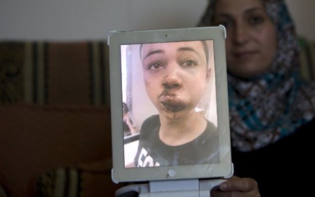 La mère de Tariq Abou Khdeir (le cousin de l'adolescent tué) montre une image de son fils qui aurait été battu par la police israélienne à Jérusalem-Est le 5 juillet 2014 (Crédit photo: Ahmad Gharabli / AFP)