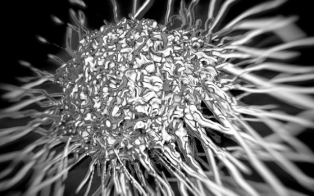 Illustration d'une cellule cancéreuse (Crédit : via http://www.shutterstock.com/pic-137993720/stock-photo--d-rendered-close-up-of-a-cancer-cell-in-a-microscopic-view-cancer-cell-cell-tumor.html?src=liWjF9neGeJ-yzMnjfieiQ-1-31) Illustration d'une cellule cancéreuse (Crédit : via http://www.shutterstock.com/pic-137993720/stock-photo--d-rendered-close-up-of-a-cancer-cell-in-a-microscopic-view-cancer-cell-cell-tumor.html?src=liWjF9neGeJ-yzMnjfieiQ-1-31)