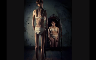 Illustration d'une femme anorexique devant le miroir (Crédit : capture d’écran YouTube)