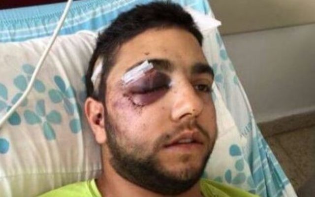 Le soldat de Tsahal druze Razzi Houseysa de Daliyat al-Carmel agressé vendredi 6 février 2015, apparemment après avoir été entendu parler l'arabe dans une boîte de nuit dans le nord d'Israël. (Crédit : Autorisation) Le soldat de Tsahal druze Razzi Houseysa de Daliyat al-Carmel agressé vendredi 6 février 2015, apparemment après avoir été entendu parler l'arabe dans une boîte de nuit dans le nord d'Israël. (Crédit : Autorisation)