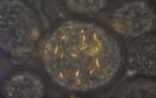 Des Nanotiges en or à l'intérieur d'une cellule (Crédit : Capture d'écran YouTube)