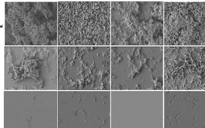 Les surfaces contrôles, non traitées, montre une colonisation bactérienne dense (en haut), alors que le revêtement FMC-Cu empêche la formation de biofilm, en bas. (Crédit : autorisation)