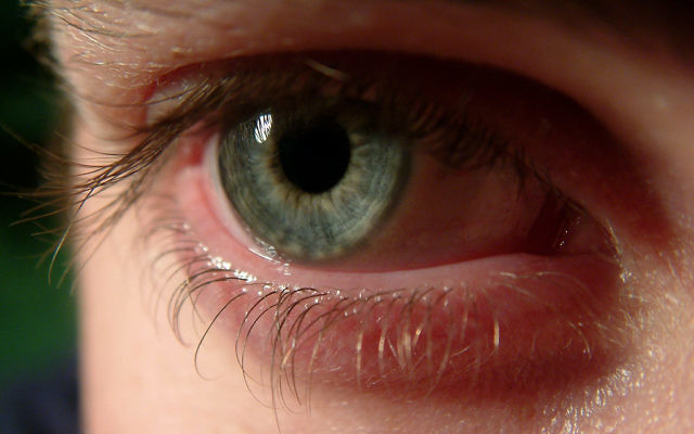 Illustration d'un oeil (Crédit : CC BY Samuel Johnson/Flickr) Illustration d'un oeil (Crédit : CC BY Samuel Johnson/Flickr)