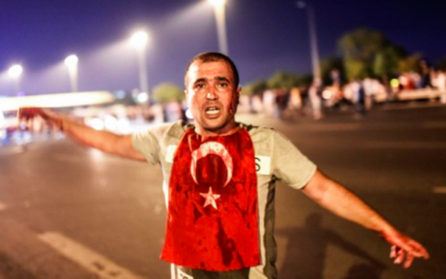 Un homme couvert de sang se trouve près du pont du Bosphore au milieu d'affrontements militaires turcs avec des personnes à l'entrée du pont à Istanbul le 16 juillet 2016. (Crédit : AFP / Bulent KILIC) Un homme couvert de sang se trouve près du pont du Bosphore au milieu d'affrontements militaires turcs avec des personnes à l'entrée du pont à Istanbul le 16 juillet 2016. (Crédit : AFP / Bulent KILIC)